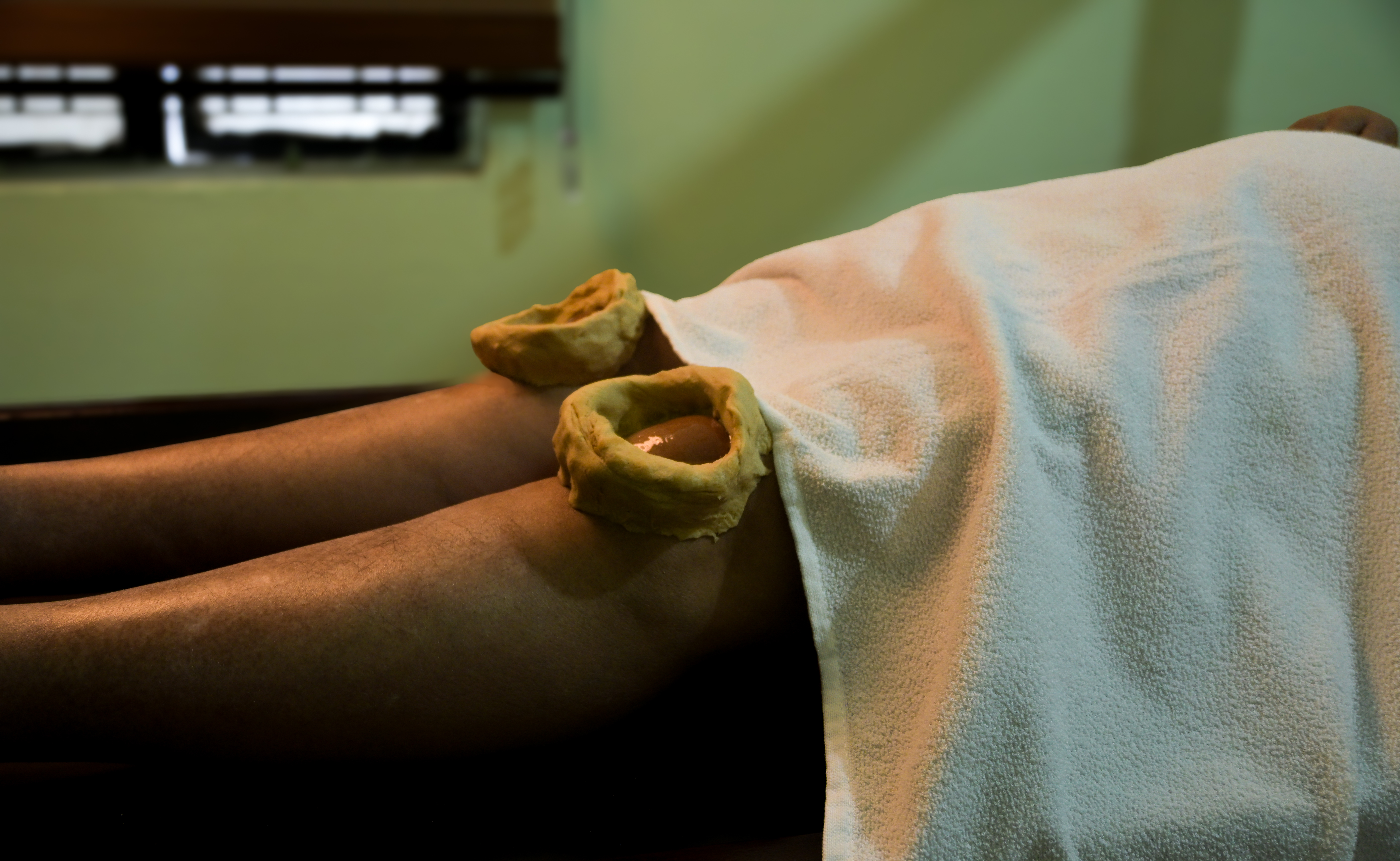 Janu Basti (Knee treatment)